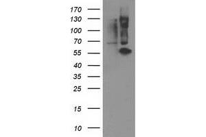 Western Blotting (WB) image for anti-Protein Phosphatase, Mg2+/Mn2+ Dependent, 1B (PPM1B) antibody (ABIN1500372) (PPM1B anticorps)