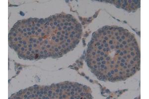 Used in DAB staining on fromalin fixed paraffin- embedded kidney tissue