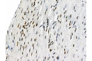 Phospho-Smad5 (Ser463/Ser465) Antibody at 1/100 staining Rat heart tissue by IHC-P. (SMAD5 anticorps  (pSer463, pSer465))
