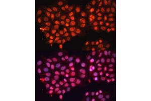 Immunofluorescence analysis of HeLa cells using  Polyclonal Antibody (ABIN3016382, ABIN3016383, ABIN3016384 and ABIN6219737) at dilution of 1:100 (40x lens).