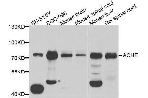 Western blot analysis of extracts of various cell lines, using ACHE antibody. (Acetylcholinesterase anticorps  (AA 398-617))