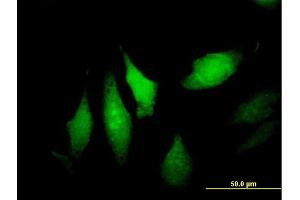 Immunofluorescence of purified MaxPab antibody to DNALI1 on HeLa cell. (DNALI1 anticorps  (AA 1-258))