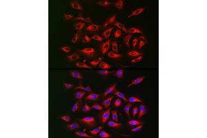 Immunofluorescence analysis of U2OS cells using IRS2 Rabbit pAb (ABIN6128094, ABIN6142544, ABIN6142545 and ABIN6223949) at dilution of 1:25 (40x lens). (IRS2 anticorps  (AA 510-650))