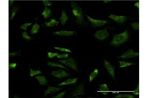 Immunofluorescence of monoclonal antibody to LOC402176 on HeLa cell. (RPL21P44 anticorps  (AA 1-136))