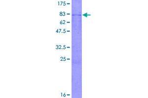 Image no. 1 for Dihydrolipoamide S-Succinyltransferase (E2 Component of 2-Oxo-Glutarate Complex) (DLST) (AA 1-453) protein (GST tag) (ABIN1351689)