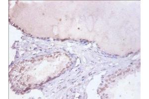 Immunohistochemistry of paraffin-embedded human prostate tissue using ABIN7155104 at dilution of 1:100 (HNRNPD/AUF1 anticorps  (AA 18-355))