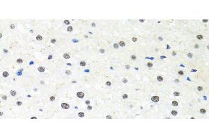 Immunohistochemistry of paraffin-embedded Rat liver using PPP4C Polyclonal Antibody at dilution of 1:100 (40x lens). (PPP4C anticorps)