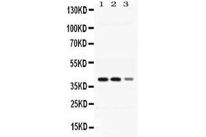 Western blot analysis of ADH4 expression in rat liver extract ( Lane 1), mouse liver extract ( Lane 2) and HEPG2 whole cell lysates ( Lane 3). (ADH4 anticorps  (AA 218-380))