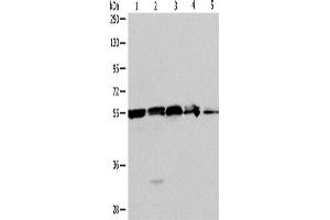 Western Blotting (WB) image for anti-Nicotinamide phosphoribosyltransferase (NAMPT) antibody (ABIN2428901) (NAMPT anticorps)