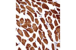 ACTA1/alpha -actin Antibody immunohistochemistry analysis in formalin fixed and paraffin embedded human skeletal muscle followed by peroxidase conjugation of the secondary antibody and DAB staining. (Actin anticorps  (C-Term))