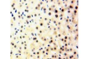 Used in DAB staining on fromalin fixed paraffin-embedded Liver tissue
