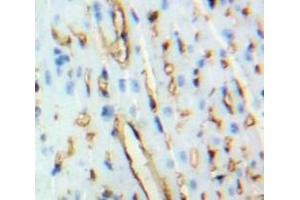 Used in DAB staining on fromalin fixed paraffin-embedded Heart tissue (BNP anticorps  (AA 77-121))