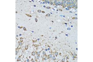 Immunohistochemistry of paraffin-embedded mouse brain using FDFT1 antibody (ABIN5973667) at dilution of 1/100 (40x lens).