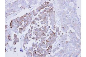 IHC-P Image Immunohistochemical analysis of paraffin-embedded OVCAR3 xenograft, using ERP29, antibody at 1:500 dilution.
