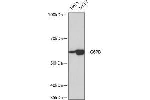 Western blot analysis of extracts of various cell lines, using G6PD Rabbit mAb (ABIN7267402) at 1:1000 dilution. (Glucose-6-Phosphate Dehydrogenase anticorps)