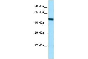 WB Suggested Anti-PLA2G3 Antibody Titration: 1. (PLA2G3 anticorps  (C-Term))