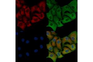 ABIN6258423 and ABIN6276238 staining Hela cells by IF/ICC. (GIPR anticorps  (Internal Region))