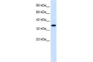 Western Blotting (WB) image for anti-Zinc Finger Protein 75 (ZNF75) antibody (ABIN2461224) (ZNF75 anticorps)
