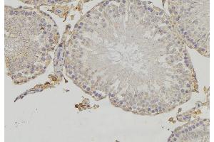 ABIN6273477 at 1/100 staining RAT testis tissue by IHC-P. (CYLC1 anticorps)