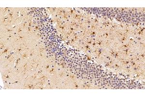 Detection of SIRT3 in Rat Cerebrum Tissue using Polyclonal Antibody to Sirtuin 3 (SIRT3)