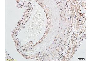 Formalin-fixed and paraffin embedded rat aorta labeled with Anti-LOX-1 Polyclonal Antibody, Unconjugated  followed by conjugation to the secondary antibody and DAB staining (OLR1 anticorps  (AA 201-273))