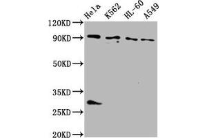 Western Blot Positive WB detected in: Hela whole cell lysate, K562 whole cell lysate, HL60 whole cell lysate, A549 whole cell lysate All lanes: BICD2 antibody at 4 μg/mL Secondary Goat polyclonal to rabbit IgG at 1/50000 dilution Predicted band size: 94, 97 kDa Observed band size: 94 kDa (BICD2 anticorps  (AA 511-625))