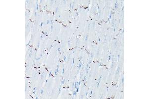 Immunohistochemistry of paraffin-embedded rat heart using N-Cadherin Rabbit pAb (ABIN3017242, ABIN3017243, ABIN3017244 and ABIN6220011) at dilution of 1:50 (40x lens).