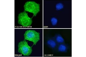 ABIN334381 Immunofluorescence analysis of paraformaldehyde fixed A431 cells, permeabilized with 0. (CXCR3 anticorps  (C-Term))