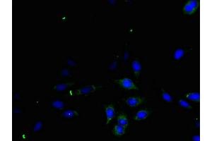 Immunofluorescent analysis of Hela cells using ABIN7166593 at dilution of 1:100 and Alexa Fluor 488-congugated AffiniPure Goat Anti-Rabbit IgG(H+L) (TGFA anticorps  (AA 40-89))