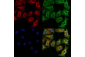 ABIN6255025 and ABIN6266462 staining Hela cells(heat shock treatment) by IF/ICC. (RIPK2 anticorps  (pSer176))