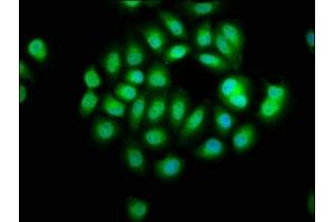 Immunofluorescence staining of A549 cells with ABIN7169333 at 1:66, counter-stained with DAPI.