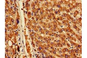 Immunohistochemistry of paraffin-embedded human liver tissue using ABIN7142170 at dilution of 1:100 (OAS1 anticorps  (AA 296-395))