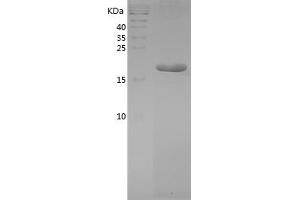 Western Blotting (WB) image for Interleukin 1, beta (IL1B) (AA 115-266) protein (His tag) (ABIN7123529)