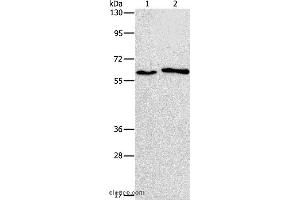 Western blot analysis of A172 and A549 cell, using CHRNA2 Polyclonal Antibody at dilution of 1:950 (CHRNA2 anticorps)