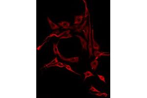 ABIN6275770 staining HepG2 by IF/ICC. (IL13RA2 anticorps  (C-Term))