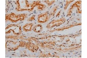 ABIN6267400 at 1/200 staining Human kidney tissue sections by IHC-P. (CREB1 anticorps  (pSer133))