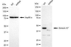 Western blotting analysis using Annexin A7 antibody (ABIN7797626). (Recombinant Annexin VII anticorps)