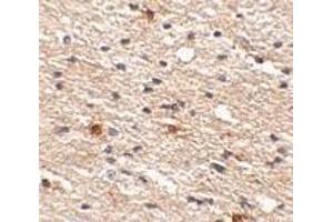 anti-Aryl Hydrocarbon Receptor Interacting Protein-Like 1 (AIPL1) (C-Term) antibody