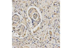 Immunohistochemistry (IHC) image for anti-HUS1 Checkpoint Homolog (S. Pombe) (HUS1) antibody (ABIN1876595) (HUS1 anticorps)