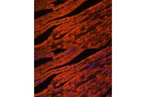 Immunofluorescence analysis of mouse heart cells using LDB3 antibody (ABIN6128179, ABIN6143125, ABIN6143126 and ABIN6223347) at dilution of 1:100.