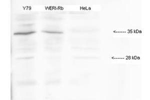 HMX1 antibody - middle region  validated by WB using Y79, WERI-(human retinoblastoma cell lines), HeLa-(human papilloma virus cell line) at 1:1000. (HMX1 anticorps  (Middle Region))