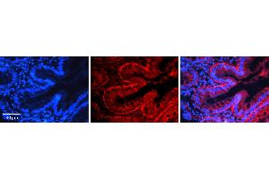 Rabbit Anti-NFKB2 Antibody   Formalin Fixed Paraffin Embedded Tissue: Human Appendix (Colon) Tissue Observed Staining: Cytoplasm Primary Antibody Concentration: 1:100 Other Working Concentrations: 1:600 Secondary Antibody: Donkey anti-Rabbit-Cy3 Secondary Antibody Concentration: 1:200 Magnification: 20X Exposure Time: 0. (NFKB2 anticorps  (N-Term))