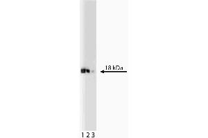 Western blot analysis of eIF-5a on a Jurkat lysate. (EIF5A anticorps  (AA 58-154))