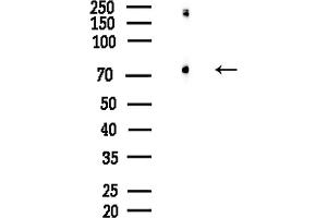 anti-Eukaryotic Translation Initiation Factor 4B (EIF4B) (pSer504) antibody