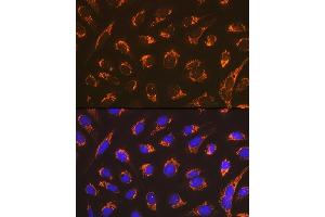 Immunofluorescence analysis of U-2 OS cells using Smac/Diablo Rabbit mAb (ABIN7270177) at dilution of 1:100 (40x lens). (DIABLO anticorps)