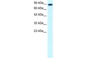 Western Blotting (WB) image for anti-Kinesin Family Member 21A (KIF21A) antibody (ABIN2460843) (KIF21A anticorps)