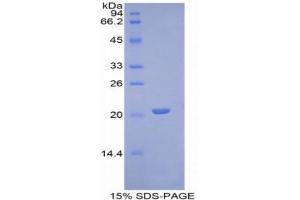 SDS-PAGE (SDS) image for Von Willebrand Factor (VWF) (AA 1498-1665) protein (His tag) (ABIN1081181)