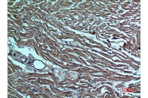 Immunohistochemistry (IHC) analysis of paraffin-embedded Human Heart, antibody was diluted at 1:100. (DR3/LARD anticorps  (Internal Region))