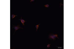 Immunofluorescence analysis of U-251 MG cells using GFAP antibody (ABIN5970067). (GFAP anticorps)