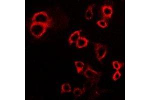 Immunofluorescent analysis of IFNGR1 staining in HepG2 cells. (IFNGR1 anticorps  (C-Term))